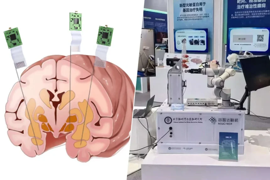 China lidera el camino en la revolución de la interfaz cerebro-computadora con su innovador chip neuronal.