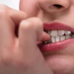¿Te Muerdes las Uñas? Estas 10 Consecuencias para Tu Salud Te Harán Pensarlo Dos Veces