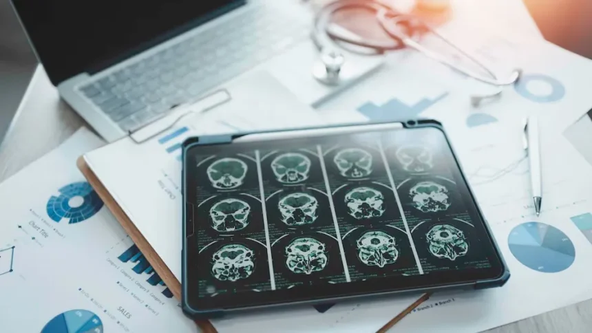 Imagen de resonancia magnética cerebral sobre una tablet en un escritorio médico, ilustrando un caso neurológico complejo como el Alzheimer juvenil.