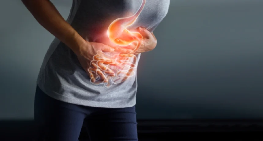 ¿Gastritis? 10 indicios para saber si lo estás padeciendo ¡No ignores las señales de tu estómago!
