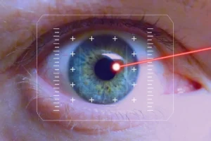 Cirugía del ojo con rayos láser: guía completa sobre procedimientos, beneficios y riesgos 2 Cirugía del ojo con rayos láser: guía completa sobre procedimientos, beneficios y riesgos
