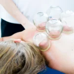 Ventosaterapia: Beneficios, Enfermedades que Trata y su Rol en la Medicina Moderna