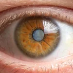 Las 2 Enfermedades Oculares Más Comunes en el Mundo y Cómo Evitarlas