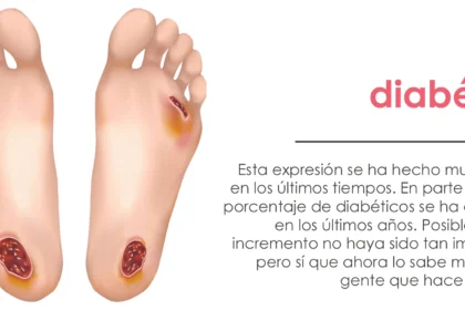 Pie diabético al descubierto: 10 datos clave que explican cómo se produce esta peligrosa complicación