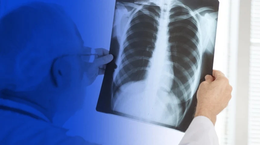 Top 10 razones por las que la radiografía es vital para el diagnóstico médico: Revelando lo invisible para salvar vidas